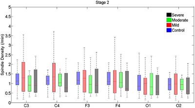 Sleep Spindle Characteristics in Obstructive Sleep Apnea Syndrome (OSAS)